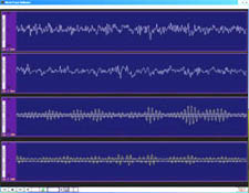 neurotrace